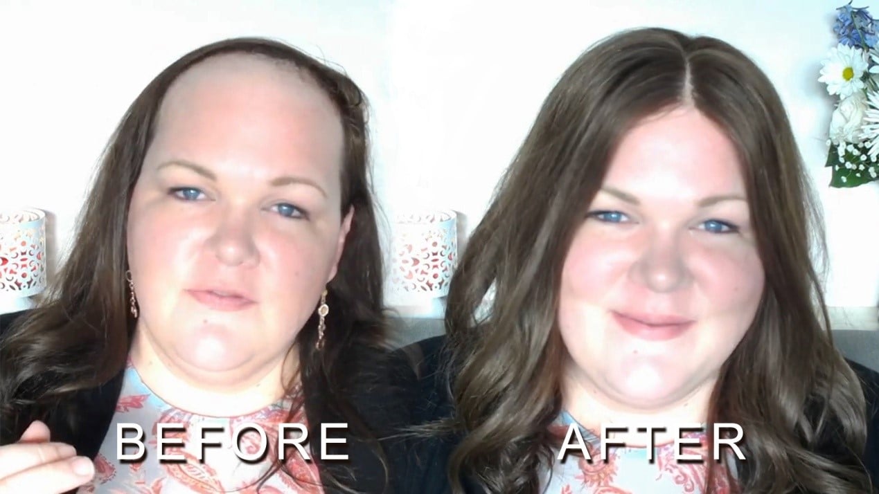 EVERYTHING YOU NEED TO KNOW ABOUT HAIR TOPPERS EVERYTHING YOU NEED TO KNOW ABOUT HAIR TOPPERS
